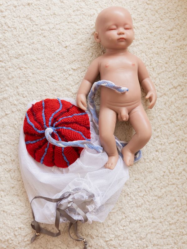 Placenta Cord Amniotic Chorionic Sac Model